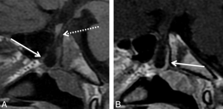Fig 3.