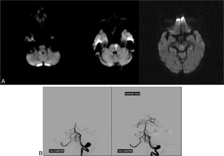 Fig 2.