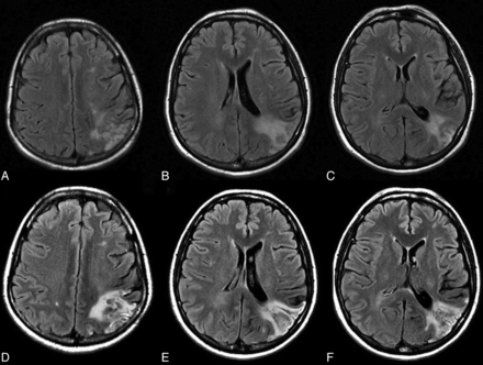 Fig 3.