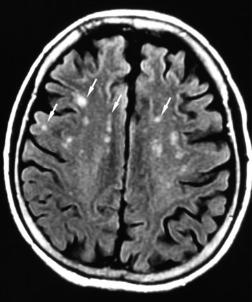 Fig 1.