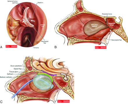 Fig 1.