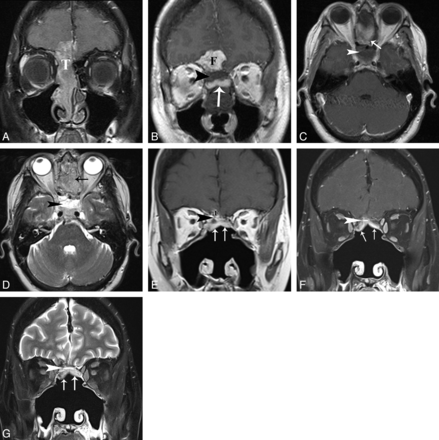 Fig 4.
