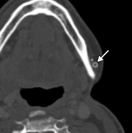 Fig 10.