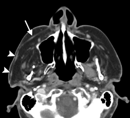 Fig 13.