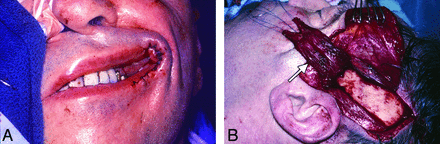 Fig 14.