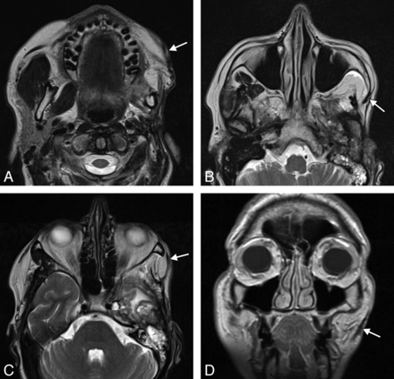 Fig 15.