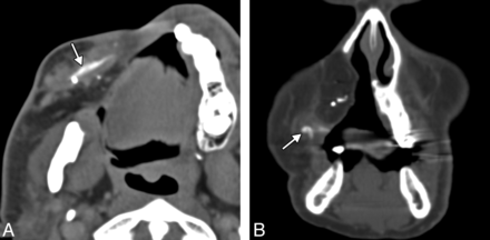 Fig 16.