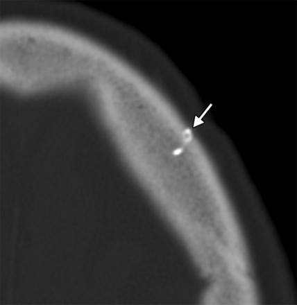 Fig 2.
