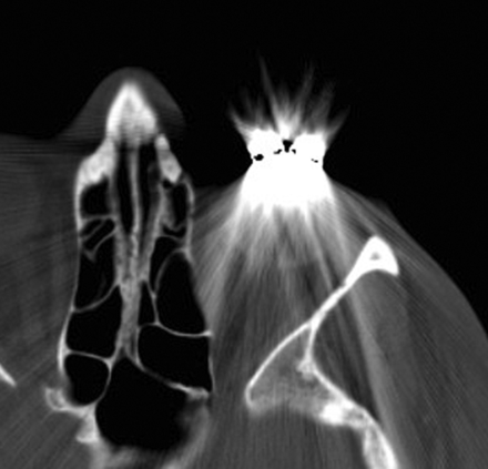 Fig 4.