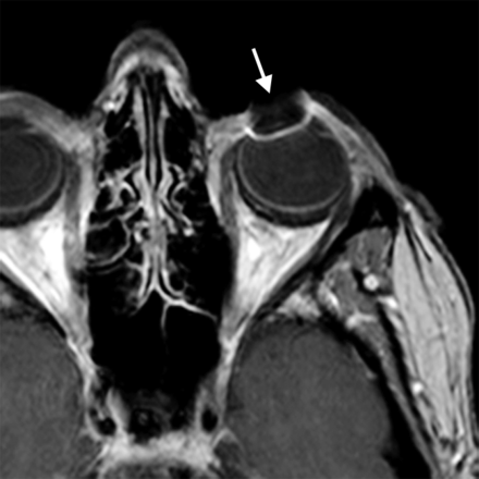 Fig 5.