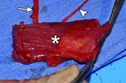 Fig 8.