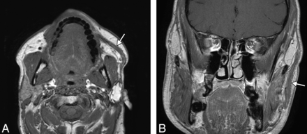 Fig 9.