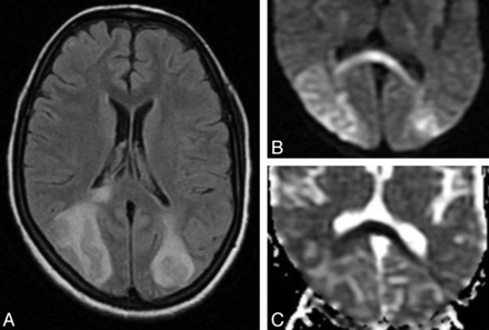 Fig 2.