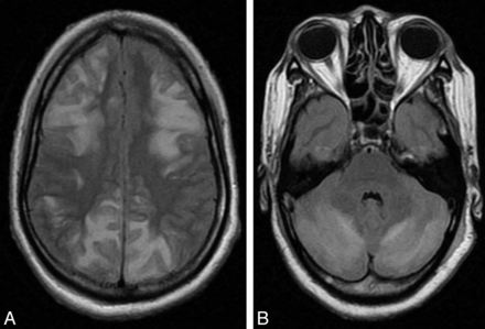Fig 3.