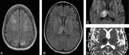 Fig 4.