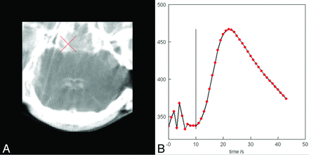 Fig 3.