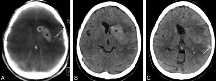 Fig 1.