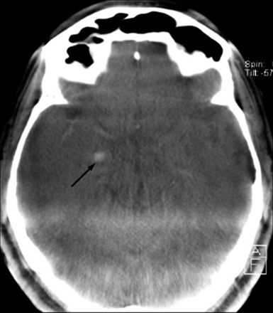Fig 2.