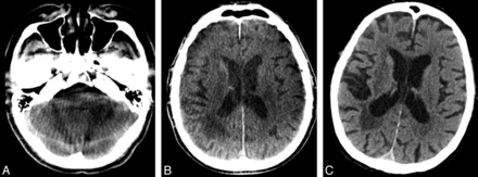 Fig 3.