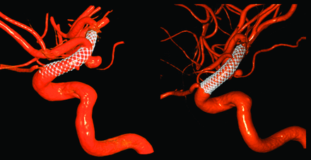 Fig 2.