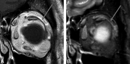 Fig 2.