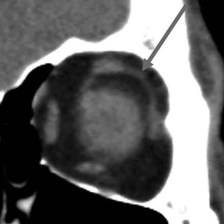 Fig 3.