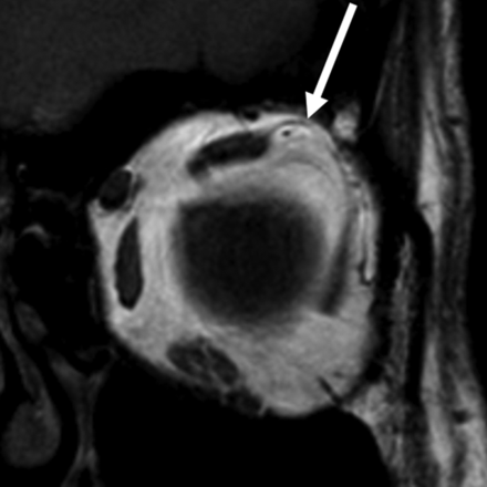 Fig 4.