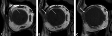 Fig 5.