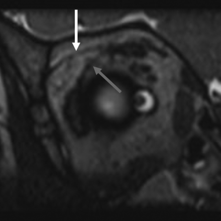 Fig 6.