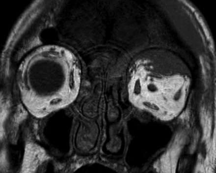 Fig 8.