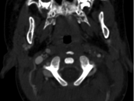 Fig 2.