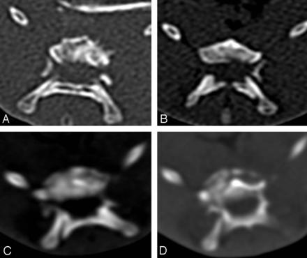 Fig 3.