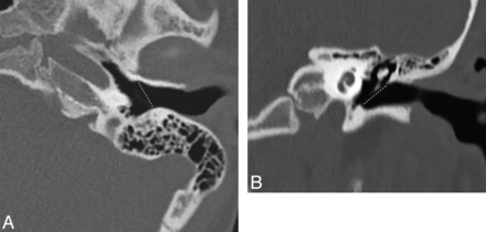 Fig 1.