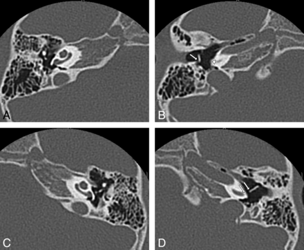 Fig 2.