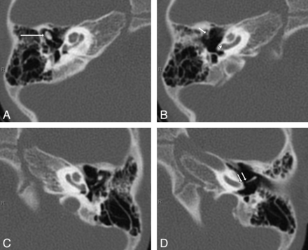 Fig 3.