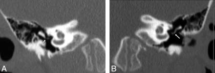 Fig 5.