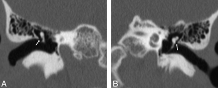 Fig 6.
