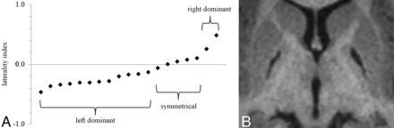 Fig 2.
