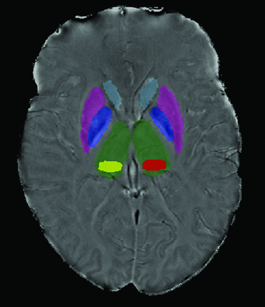 Fig 1.