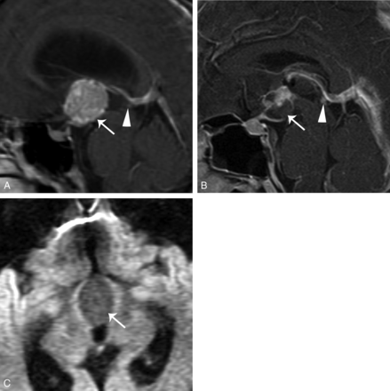 Fig 2.