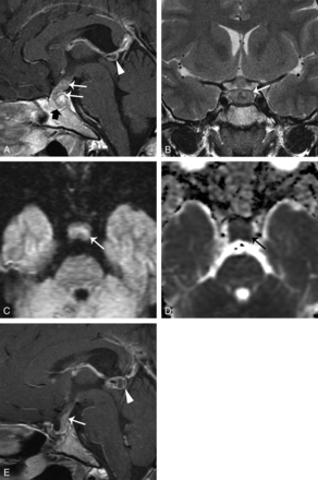 Fig 3.