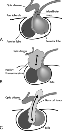 Fig 5.