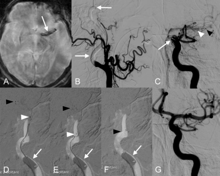 Fig 1.