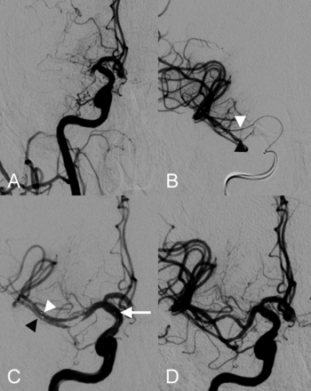 Fig 2.