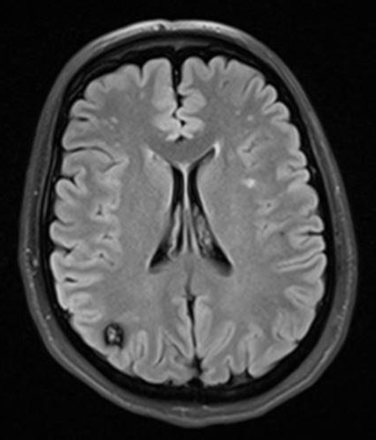 Fig 1.