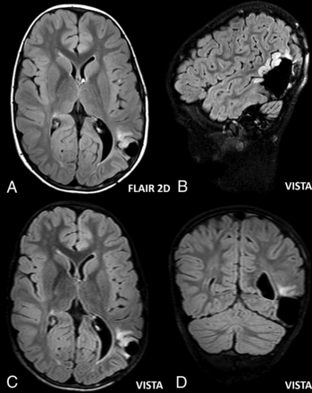 Fig 4.