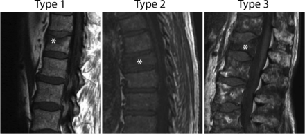 Fig 2.