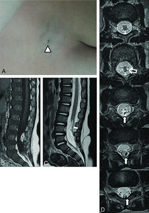 Fig 2.
