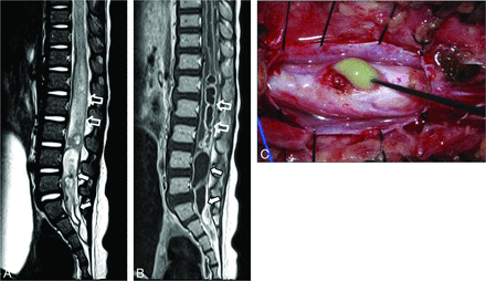 Fig 3.