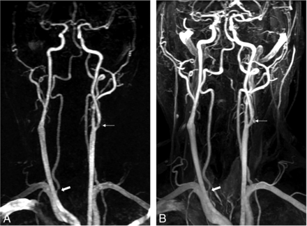 Fig 3.